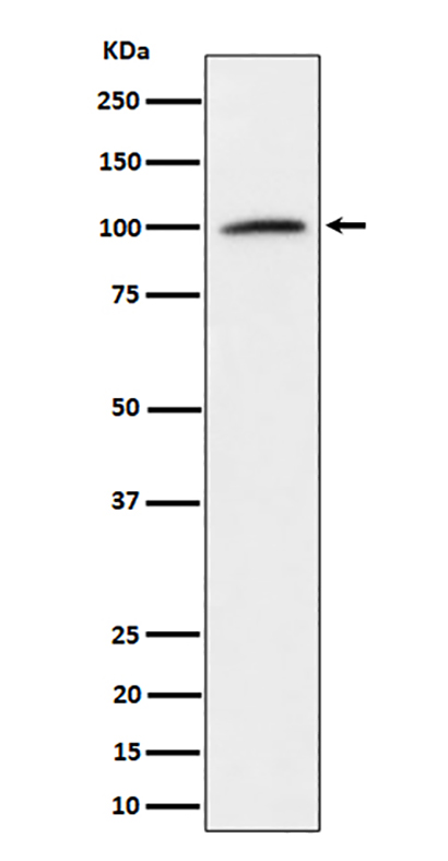 Nucleolin (7Z11)兔单抗,Nucleolin (7Z11) Rabbit Monoclonal Antibody