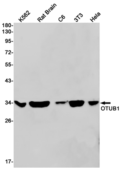 OTUB1 (7P2)兔单抗,OTUB1 (7P2) Rabbit Monoclonal Antibody