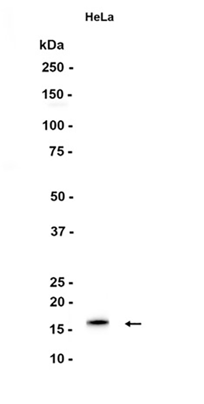 p16 INK (16J3)兔单抗,p16 INK (16J3) Rabbit Monoclonal Antibody