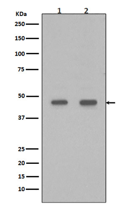 PDX1 (9B19)兔单抗,PDX1 (9B19) Rabbit Monoclonal Antibody