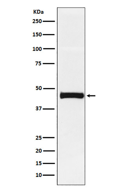 Pentraxin 3 (14E14)兔单抗,Pentraxin 3 (14E14) Rabbit Monoclonal Antibody