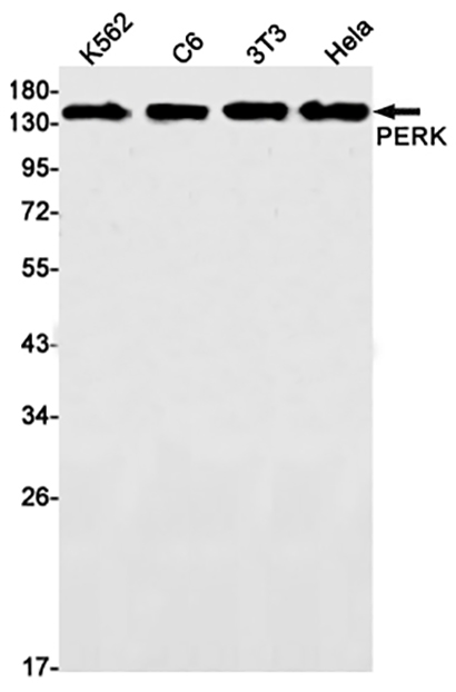 PERK (16C18)兔单抗,PERK (16C18) Rabbit Monoclonal Antibody