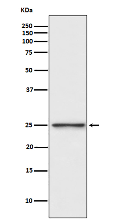 PGP9.5 (5O2)兔单抗,PGP9.5 (5O2) Rabbit Monoclonal Antibody