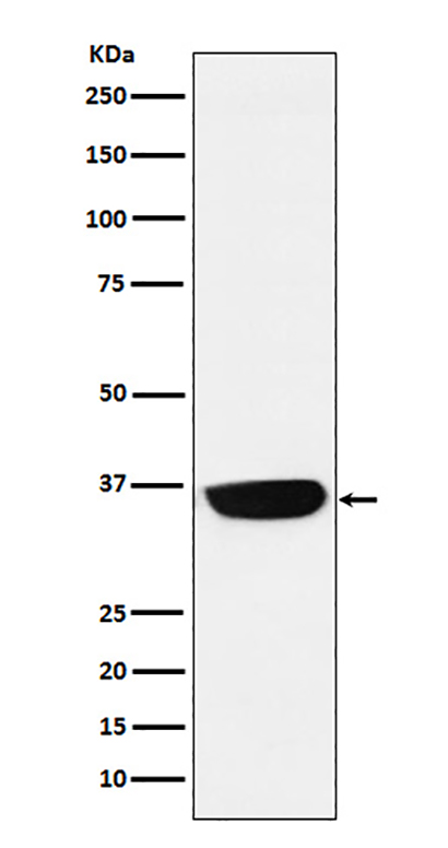PHOX2B (7H13)兔单抗,PHOX2B (7H13) Rabbit Monoclonal Antibody