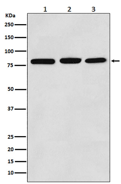 PI3 Kinase p85 alpha (4H15)兔单抗,PI3 Kinase p85 alpha (4H15) Rabbit Monoclonal Antibody