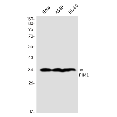 PIM1  (3I7)兔单抗,PIM1  (3I7) Rabbit Monoclonal Antibody