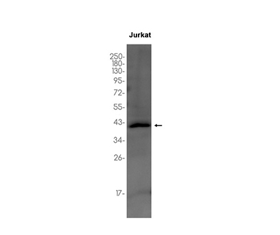 PIM2 (17I7)兔单抗,PIM2 (17I7) Rabbit Monoclonal Antibody