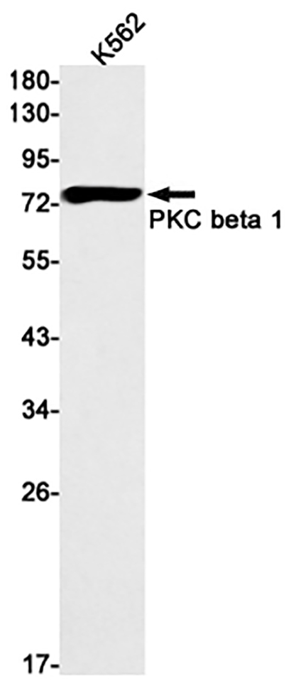 PKC beta 2  (12R10)兔单抗,PKC beta 2  (12R10) Rabbit Monoclonal Antibody