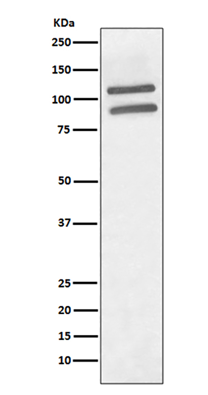 PML (11A3)兔单抗,PML (11A3) Rabbit Monoclonal Antibody