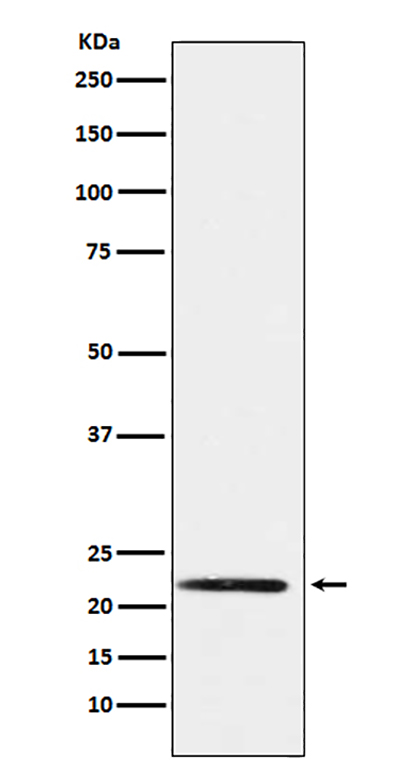 PMP22 (2M9)兔单抗,PMP22 (2M9) Rabbit Monoclonal Antibody