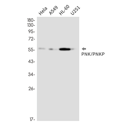PNK / PNKP (12Y10)兔单抗,PNK / PNKP (12Y10) Rabbit Monoclonal Antibody