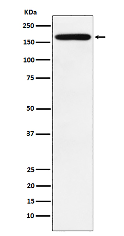 PODXL (13I5)兔单抗,PODXL (13I5) Rabbit Monoclonal Antibody