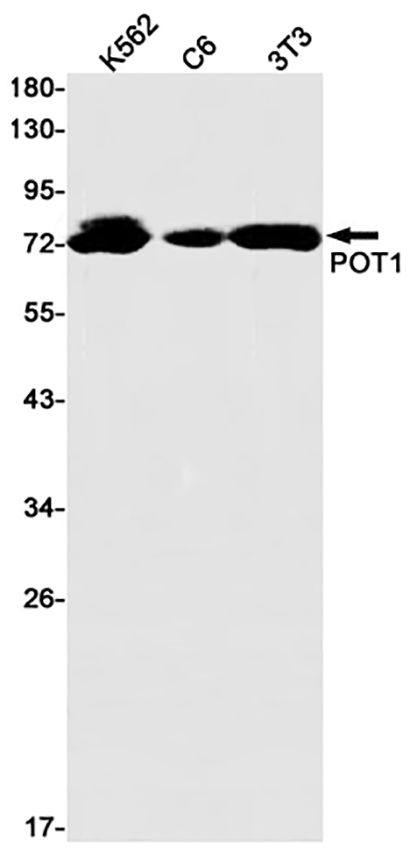 POT1 (19U2)兔单抗,POT1 (19U2) Rabbit Monoclonal Antibody
