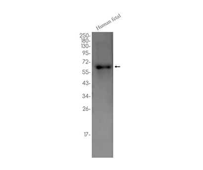 PPAR gamma (19L6)兔单抗,PPAR gamma (19L6) Rabbit Monoclonal Antibody