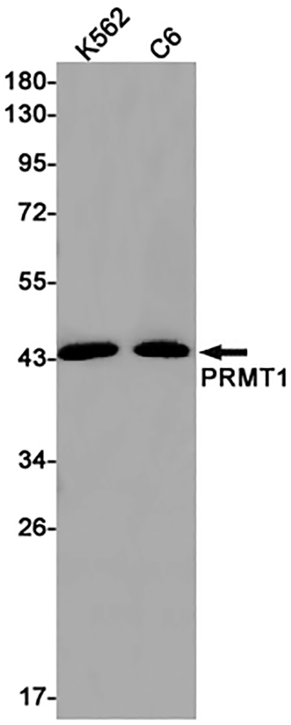 PRMT1 (2C19)兔单抗,PRMT1 (2C19) Rabbit Monoclonal Antibody
