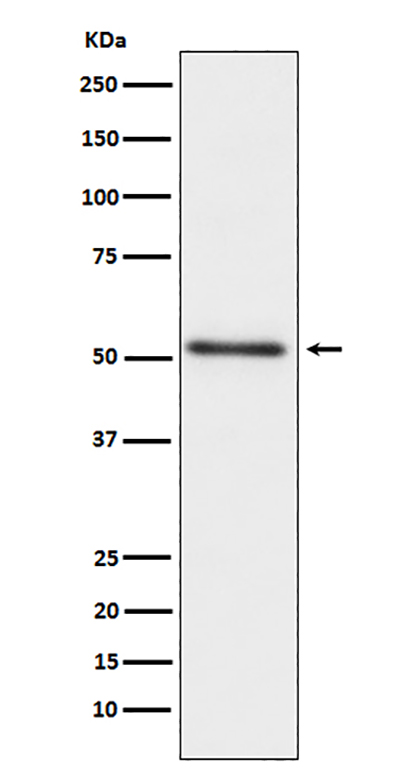 Prostatic Acid Phosphatase (14A5)兔单抗,Prostatic Acid Phosphatase (14A5) Rabbit Monoclonal Antibody