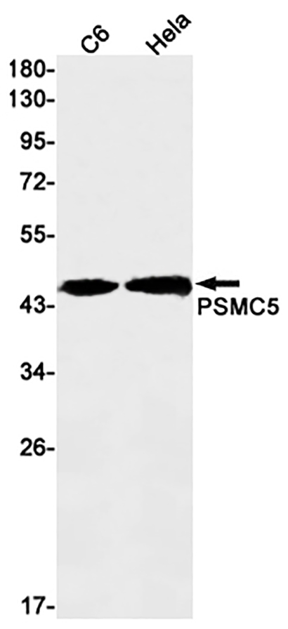 PSMC5 (17I3)兔单抗,PSMC5 (17I3) Rabbit Monoclonal Antibody