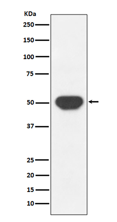 PTP1B (13P19)兔单抗,PTP1B (13P19) Rabbit Monoclonal Antibody