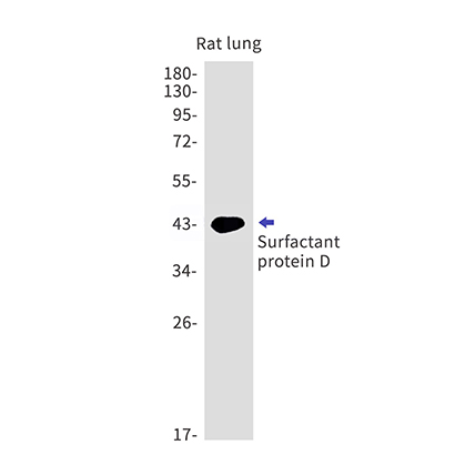 Pulmonary Surfactant Associated Protein D (13G17)兔单抗,Pulmonary Surfactant Associated Protein D (13G17) Rabbit Monoclonal Antibody