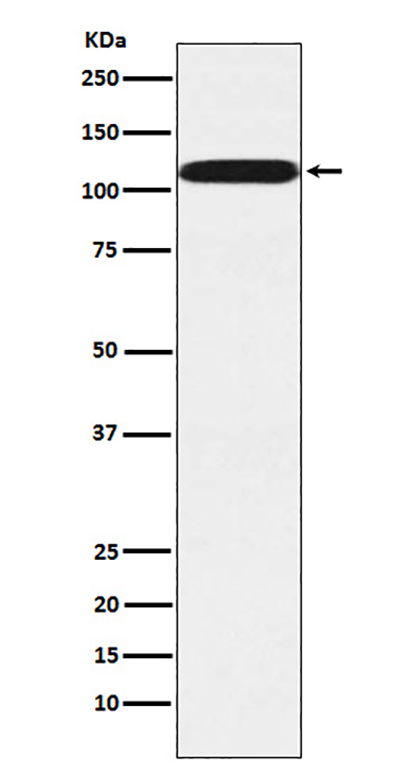Pumilio 2 (18V6)兔单抗,Pumilio 2 (18V6) Rabbit Monoclonal Antibody