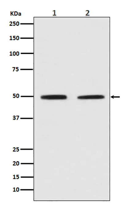 Pygopus 2 (14L2)兔单抗,Pygopus 2 (14L2) Rabbit Monoclonal Antibody