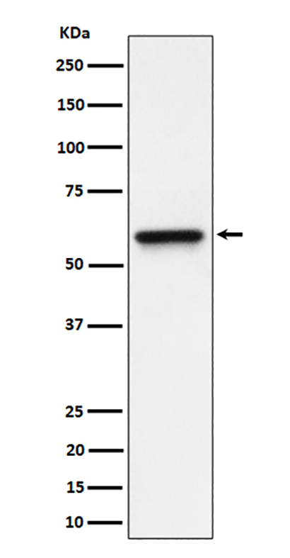 RGS6 (3A18)兔单抗,RGS6 (3A18) Rabbit Monoclonal Antibody