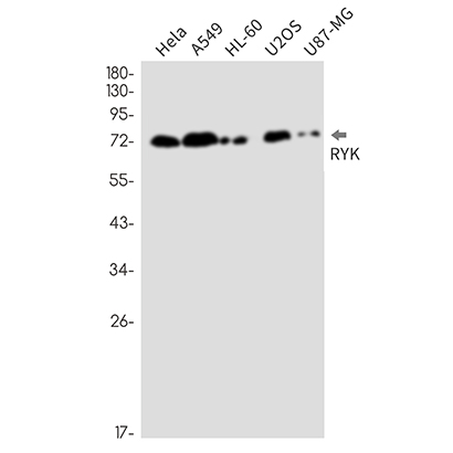 RYK (13H7)兔单抗,RYK (13H7) Rabbit Monoclonal Antibody