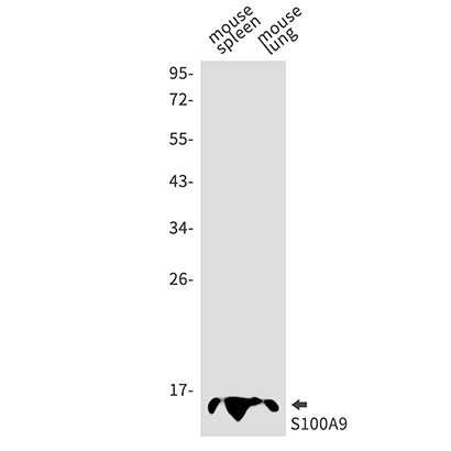 S100 alpha9 (13Z5)兔单抗,S100 alpha9 (13Z5) Rabbit Monoclonal Antibody