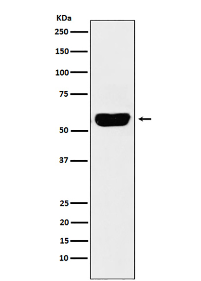 Salivary alpha amylase (5D14)兔单抗,Salivary alpha amylase (5D14) Rabbit Monoclonal Antibody