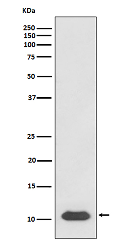 SDF1 (12B8)兔单抗,SDF1 (12B8) Rabbit Monoclonal Antibody
