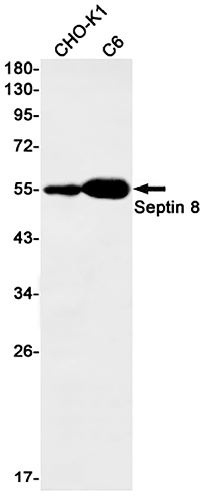 Septin 8 (18E13)兔单抗,Septin 8 (18E13) Rabbit Monoclonal Antibody