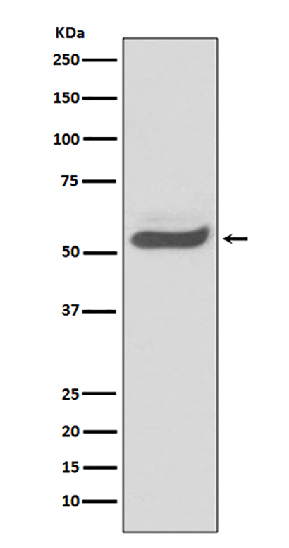 SERPINA1 (2F7)兔单抗,SERPINA1 (2F7) Rabbit Monoclonal Antibody
