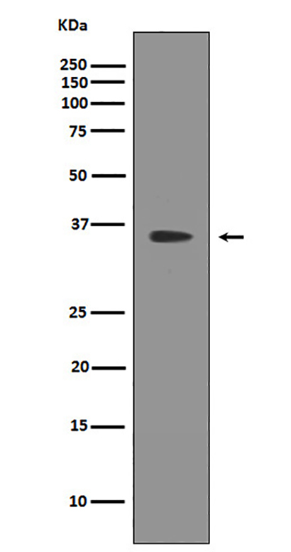 SIRT2  (7W12)兔单抗,SIRT2  (7W12) Rabbit Monoclonal Antibody