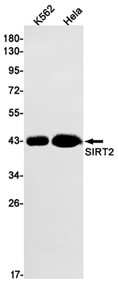 SIRT2 (4O6)兔单抗,SIRT2 (4O6) Rabbit Monoclonal Antibody