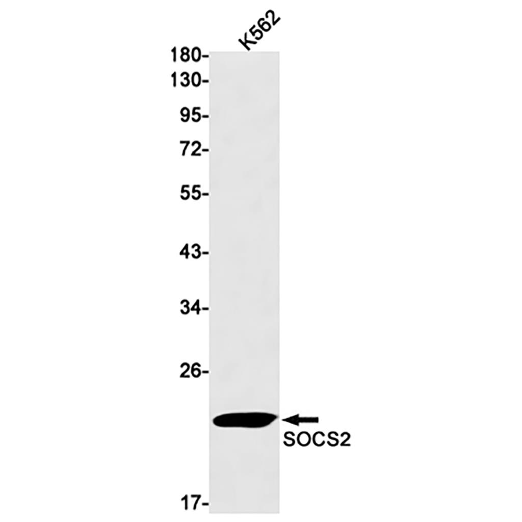 SOCS2 (3T6)兔单抗,SOCS2 (3T6) Rabbit Monoclonal Antibody
