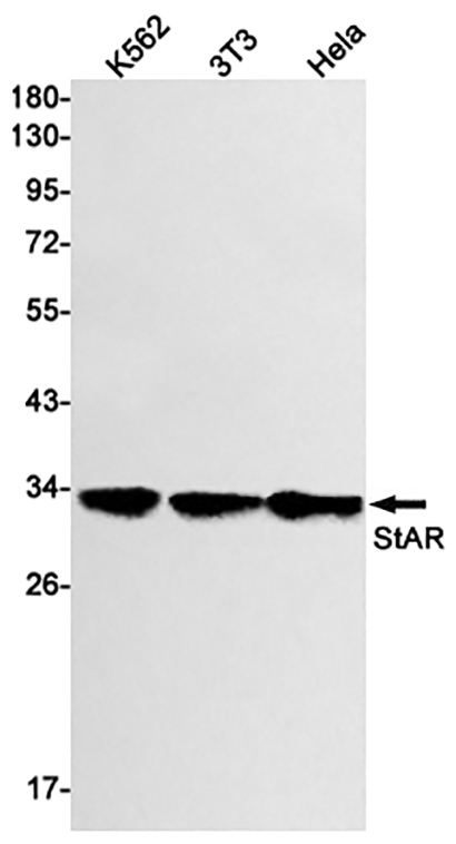 StAR (13D4)兔单抗,StAR (13D4) Rabbit Monoclonal Antibody