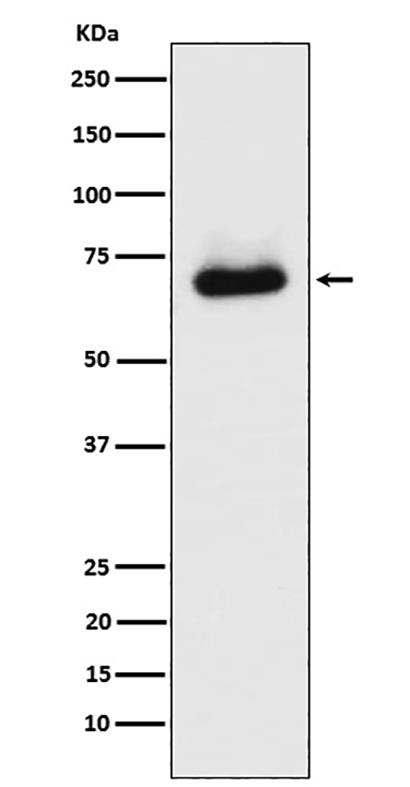 STK39 (18P19)兔单抗,STK39 (18P19) Rabbit Monoclonal Antibody