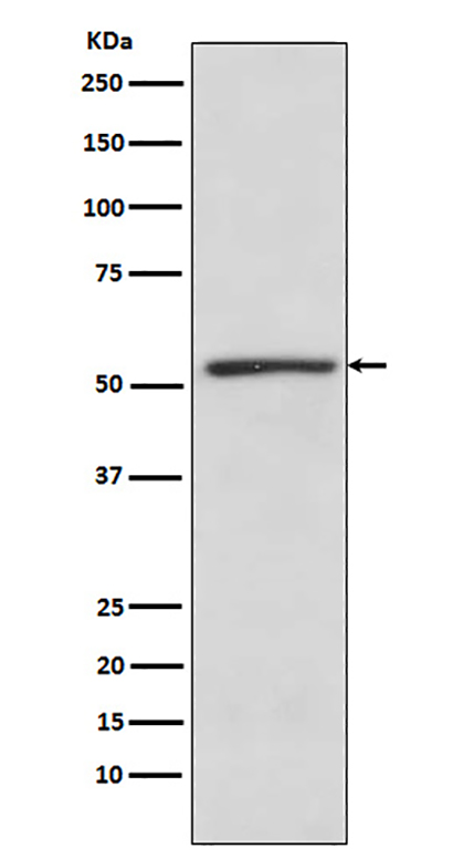 TBLR1 (6N18)兔单抗,TBLR1 (6N18) Rabbit Monoclonal Antibody