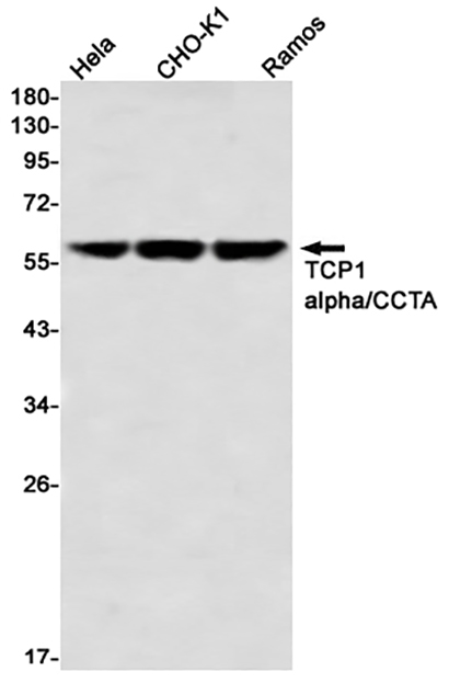 TCP1 alpha (7M19)兔单抗,TCP1 alpha (7M19) Rabbit Monoclonal Antibody