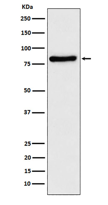 TLE1 (19X14)兔单抗,TLE1 (19X14) Rabbit Monoclonal Antibody