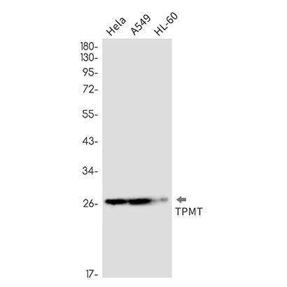 TPMT (3H2)兔单抗,TPMT (3H2) Rabbit Monoclonal Antibody