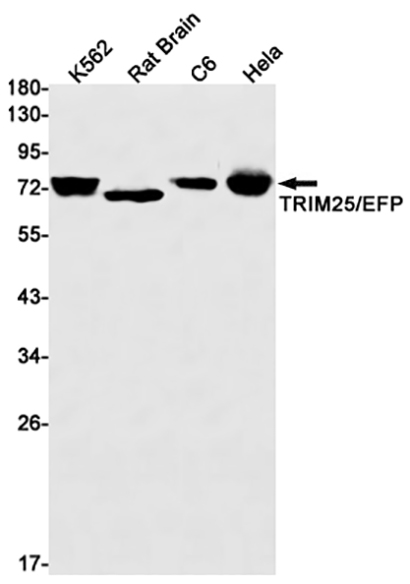 TRIM25 (1S16)兔单抗,TRIM25 (1S16) Rabbit Monoclonal Antibody