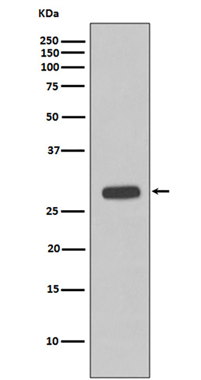 Troponin I (14Z15)兔单抗,Troponin I (14Z15) Rabbit Monoclonal Antibody