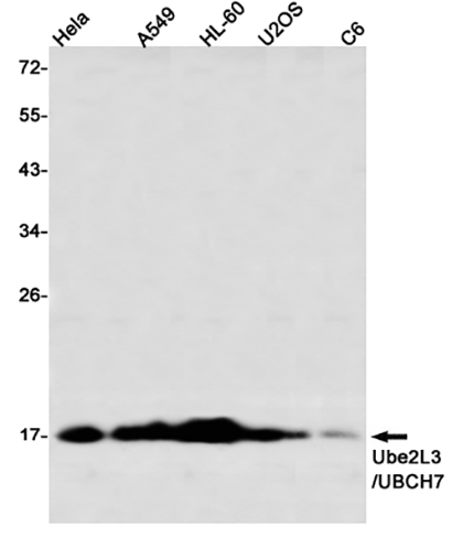 Ube2L3 / UBCH7 (11O13)兔单抗,Ube2L3 / UBCH7 (11O13) Rabbit Monoclonal Antibody