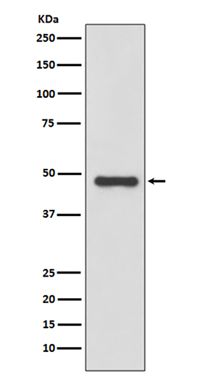 Urokinase (4A13)兔单抗,Urokinase (4A13) Rabbit Monoclonal Antibody