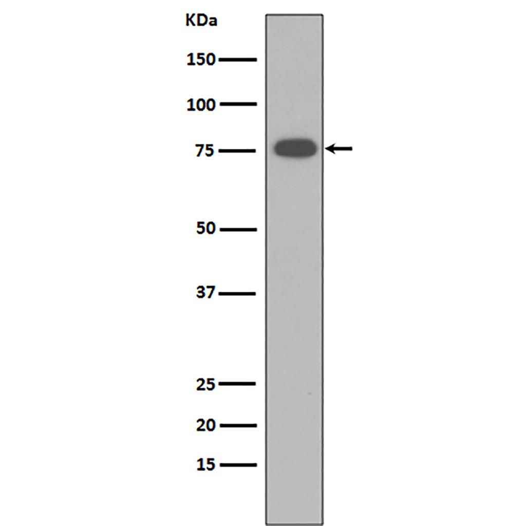 Vitronectin  (1N16)兔单抗,Vitronectin  (1N16) Rabbit Monoclonal Antibody