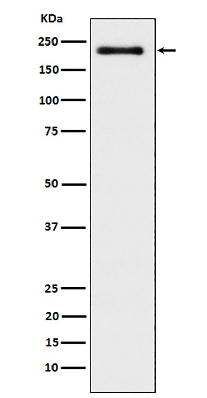 WRN (5Y12)兔单抗,WRN (5Y12) Rabbit Monoclonal Antibody