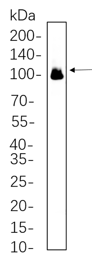 Glutamate Receptor 1兔单抗,Glutamate Receptor 1 Rabbit Monoclonal antibody