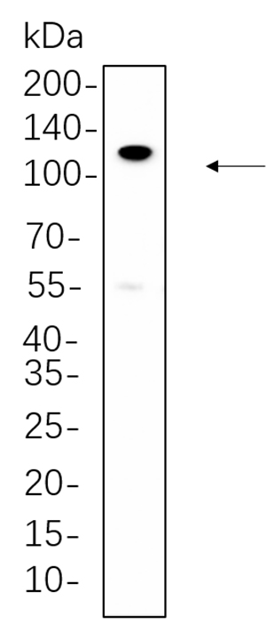 PI3-Kinase p110 β兔单抗,PI3-Kinase p110 β Rabbit Monoclonal antibody