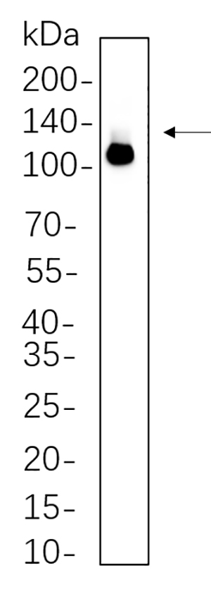 DDX58兔单抗,DDX58 Rabbit Monoclonal antibody